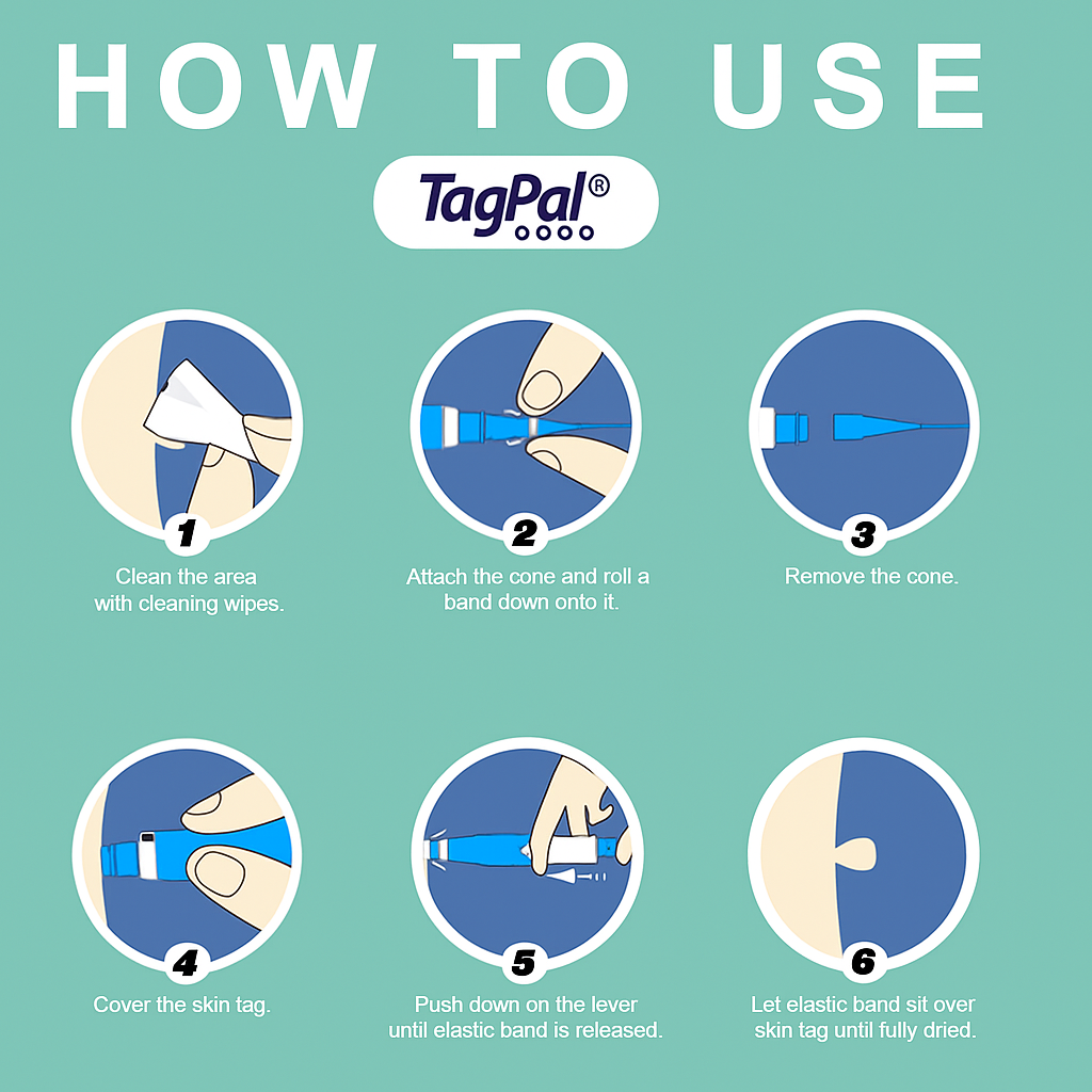 TagPal - Skin Tag Removal Kit La Tienda Nexo