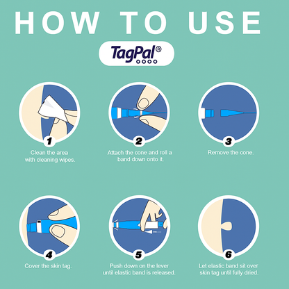 TagPal - Skin Tag Removal Kit La Tienda Nexo