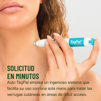 TagPal™ – Elimina Verrugas de Forma Segura y sin Dolor en Casa TAGPAL