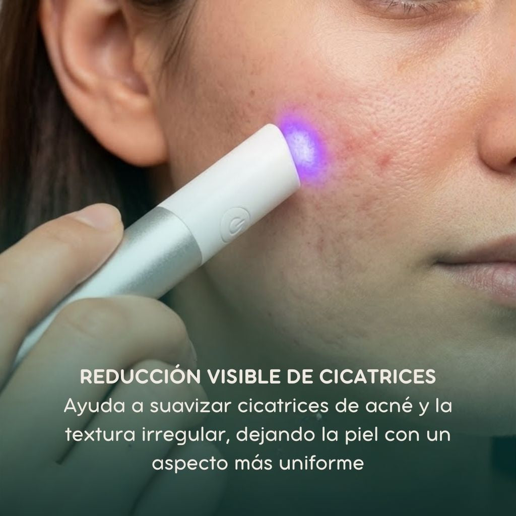 LaserClear Pro™ Elimina verrugas y manchas con precisión