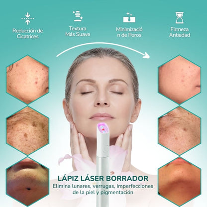 LaserClear Pro™ Elimina verrugas y manchas con precisión