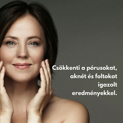 VittaLab™ Green Mask Stick – Szabadulj meg a mitesszerektől napok alatt