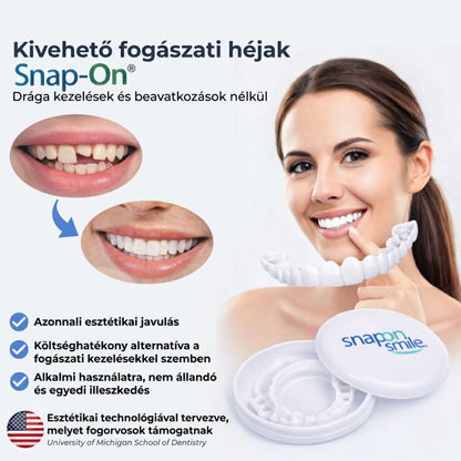 VittaLab™ Smile Cover – Tökéletes Mosoly Foghéj – Azonnali Hatás