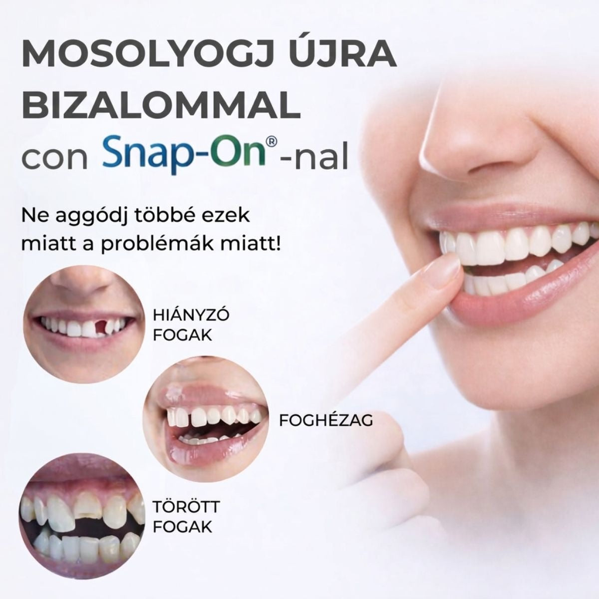 VittaLab™ Smile Cover – Tökéletes Mosoly Foghéj – Azonnali Hatás