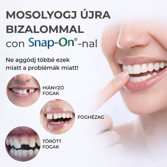 VittaLab™ Smile Cover – Tökéletes Mosoly Foghéj – Azonnali Hatás