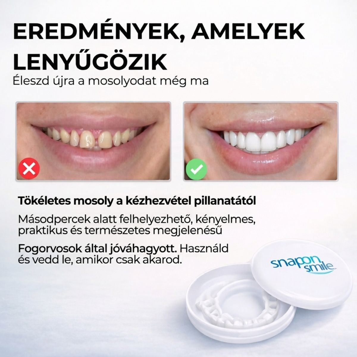VittaLab™ Smile Cover – Tökéletes Mosoly Foghéj – Azonnali Hatás