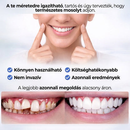 VittaLab™ Smile Cover – Tökéletes Mosoly Foghéj – Azonnali Hatás