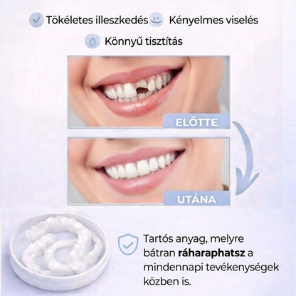 VittaLab™ Smile Cover – Tökéletes Mosoly Foghéj – Azonnali Hatás