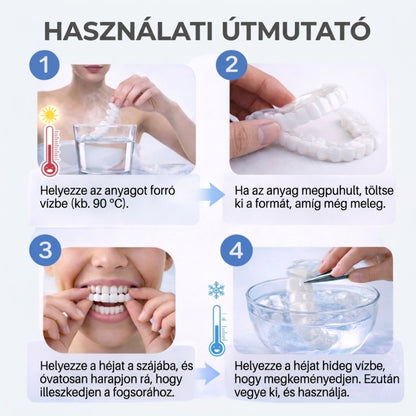 VittaLab™ Smile Cover – Tökéletes Mosoly Foghéj – Azonnali Hatás