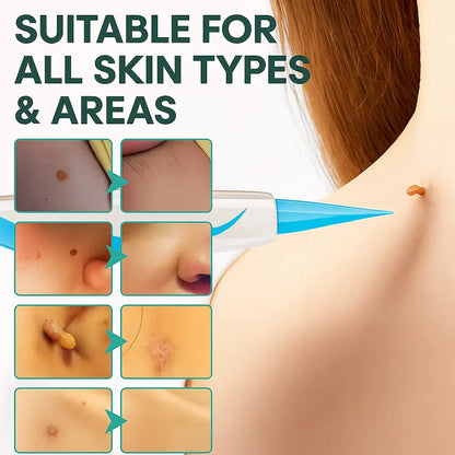 TagPal - Skin Tag Removal Kit La Tienda Nexo